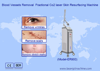 RF Fractional CO2 Laser For Stretch Marks Scar Removal Vaginal Tightening Machine