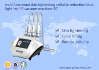 Multifunctional Skin Tightening Cellulite Reduction Blue Light Led Rf Vacuum Machine