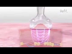 MLS05 Portable 40K Cavitation Vacuum RF Ultrasonic Cellulite Reduce Device