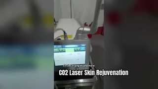 30W RF Tube Fractional Co2 Laser For Scar Removal Skin Tightening