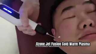 Ozone Jet Fusion Cold And Warm Plasma Machine For Skin Tightening Wrinkle Removal