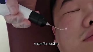 Fusion Cold And Warm Plasma Machine For Skin Tightening Wrinkle Removal