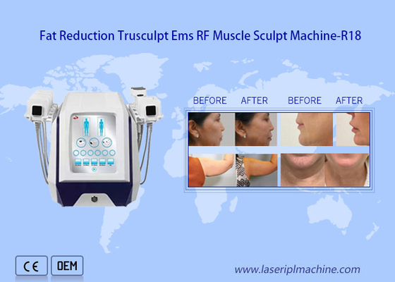 2mhz Rf Beauty Equipment Cellulite Reduction Muscle Building