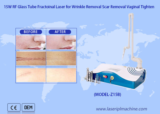 Super Pulse Fractional CO2 Laser Machine For Spot Laser Removal