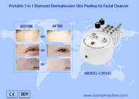 Portable 3in1 Diamond Dermabrasion Skin Peeling Facial Cleaning Machine