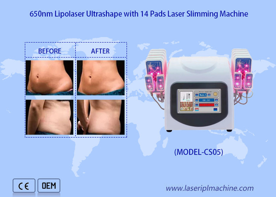 650nm Lipo Laser Pads Laser Liposuction Machine For Reduce Cellulite Fat Removal