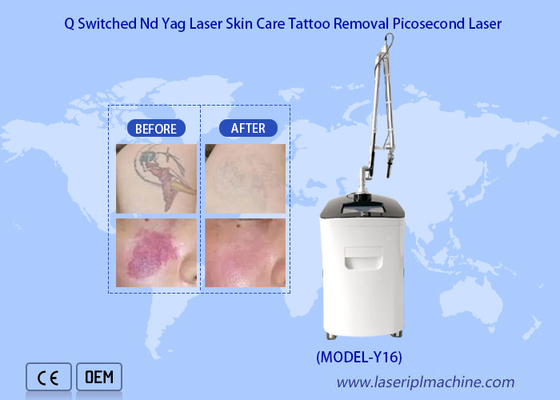 Vertical Nd Yag Picosecond Laser Machine Skin Rejuvenation Tattoo Removal