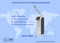 Vertical Fractional Co2 Laser Machine Pigment Removal Scar Removal