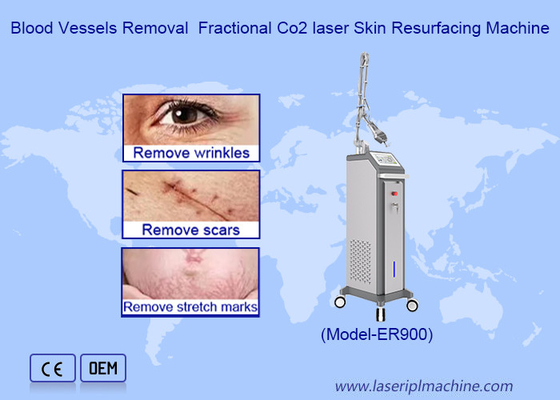 RF Fractional CO2 Laser For Stretch Marks Scar Removal Vaginal Tightening Machine