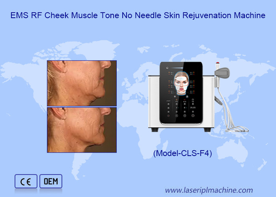 Reduction Facial Wrinkles Hi Emt Machine With 200μs Pulse And Biphasic Wave Shape