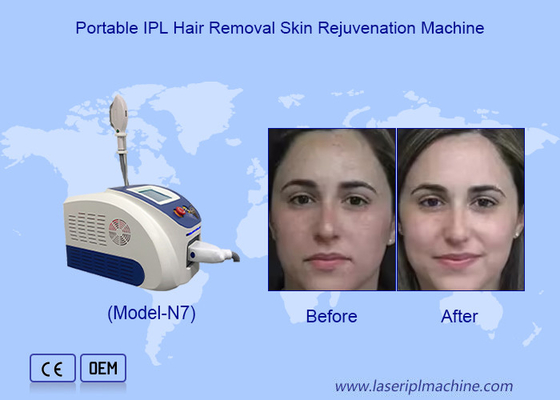 Advanced IPL Laser Hair Removal And Skin Rejuvenation With Imported Sapphire Light Crystal