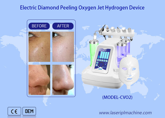 Facial Deep Cleaning  Water Oxygen Jet Peel Machine / hydro Dermabrasion water oxygen jet deep skin cleaning