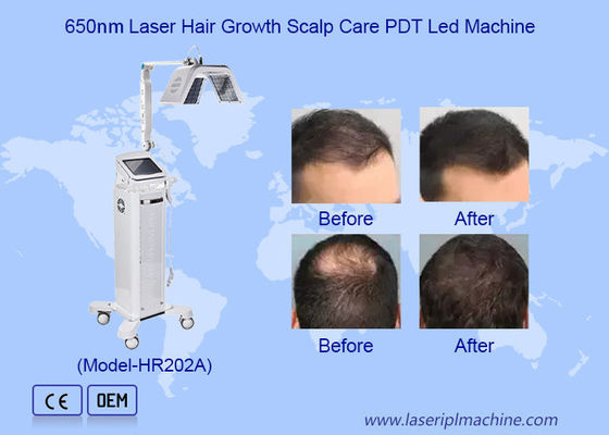 Safe High Frequency Hair Growth Stimulator Machine Laser Therapy Machine