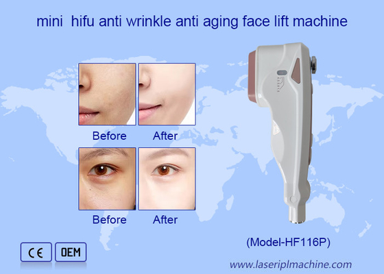 Home Use HIFU Care Facial Wrinkle Removal Skin Rejuvenation Face Lifting Machine