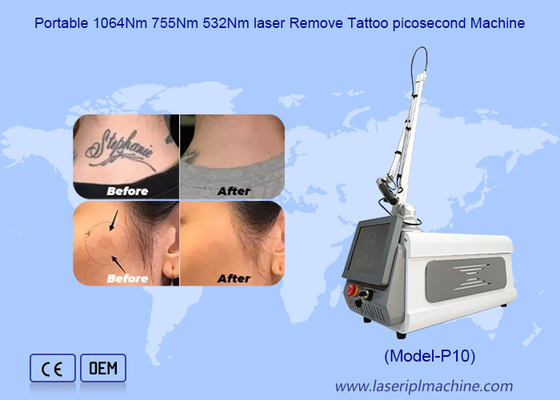 Portable Skin Whitening Picosecond Tattoo Removal Nd Yag Laser Machine