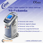 Vertical Laser Tattoo Removal Machine Removal Pigment Plaque , High Energy