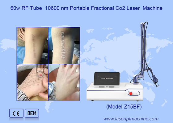 Metal RF Tube Fractional CO2 Laser For Skin Rejuvenation Vaginal Tightening