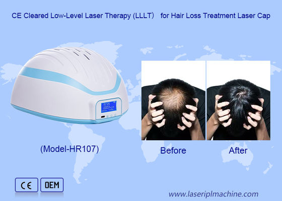 Hair Growth Device Laser Cap Hair Loss Treatment Hair Growth Helmet for Men and Women