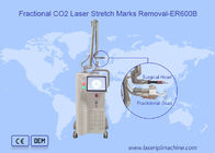 Scar Removal Scanning 10600nm 10x10mm Fractional Co2 Laser Machine