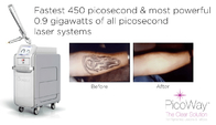 755nm Nd Yag Picosecond Laser Tattoo Removal Machine