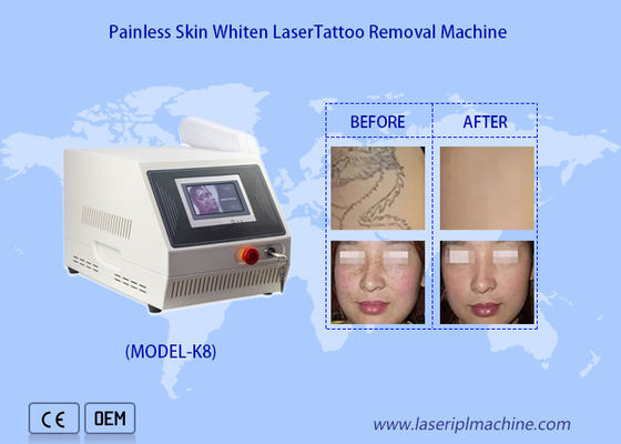 Good price 1320nm 1064nm 532nm Portable Nd Yag Laser Tattoo Removal Skin Whitening Machine online