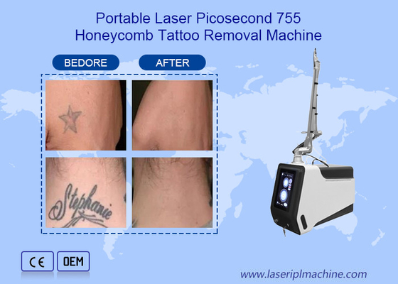 Nd Yag Picosecond Laser Tattoo Removal Machine Device 755nm 1064nm 532nm