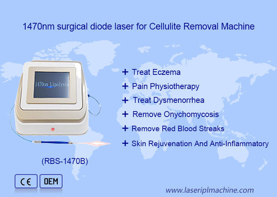 Good price 1470nm 980nm Diode Laser Lipolysis Surgery Laser Device Fat Soluble online