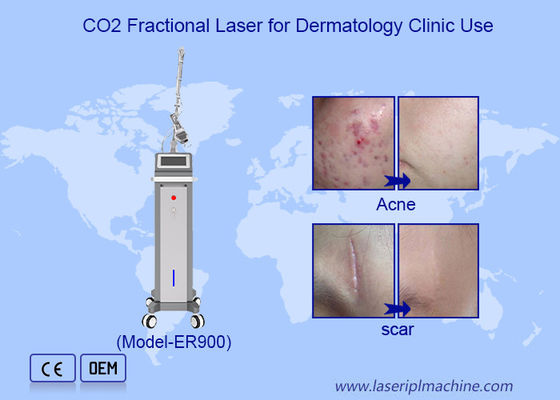 Good price 10600nm Fractional Ultrapulsed Co2 Laser Skin Resurfacing Machine online