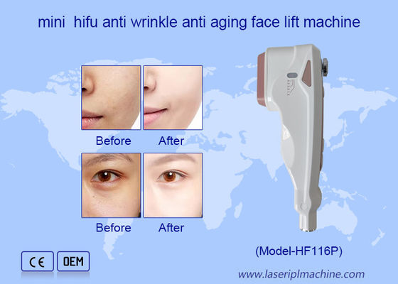 Good price Home Use HIFU Care Facial Wrinkle Removal Skin Rejuvenation Face Lifting Machine online
