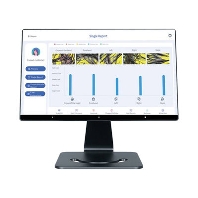 Good price 4 Languages Smart Al Scalp Analyzer Hair Scalp Care Targeted Head Machine online