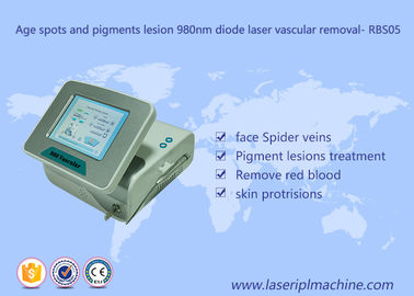 Medical Vascular Lesion Removal Age Spots And Pigments 980 nm Diode Laser